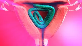 Tifa's tentacle hyperinflation (X-ray version)