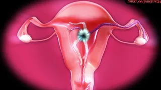 3 holes, 5 tentacles - Tifa filled up by alien lifeform