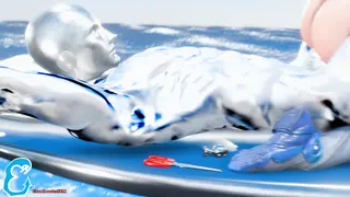 Hot Skipping The 4-Play With Sound